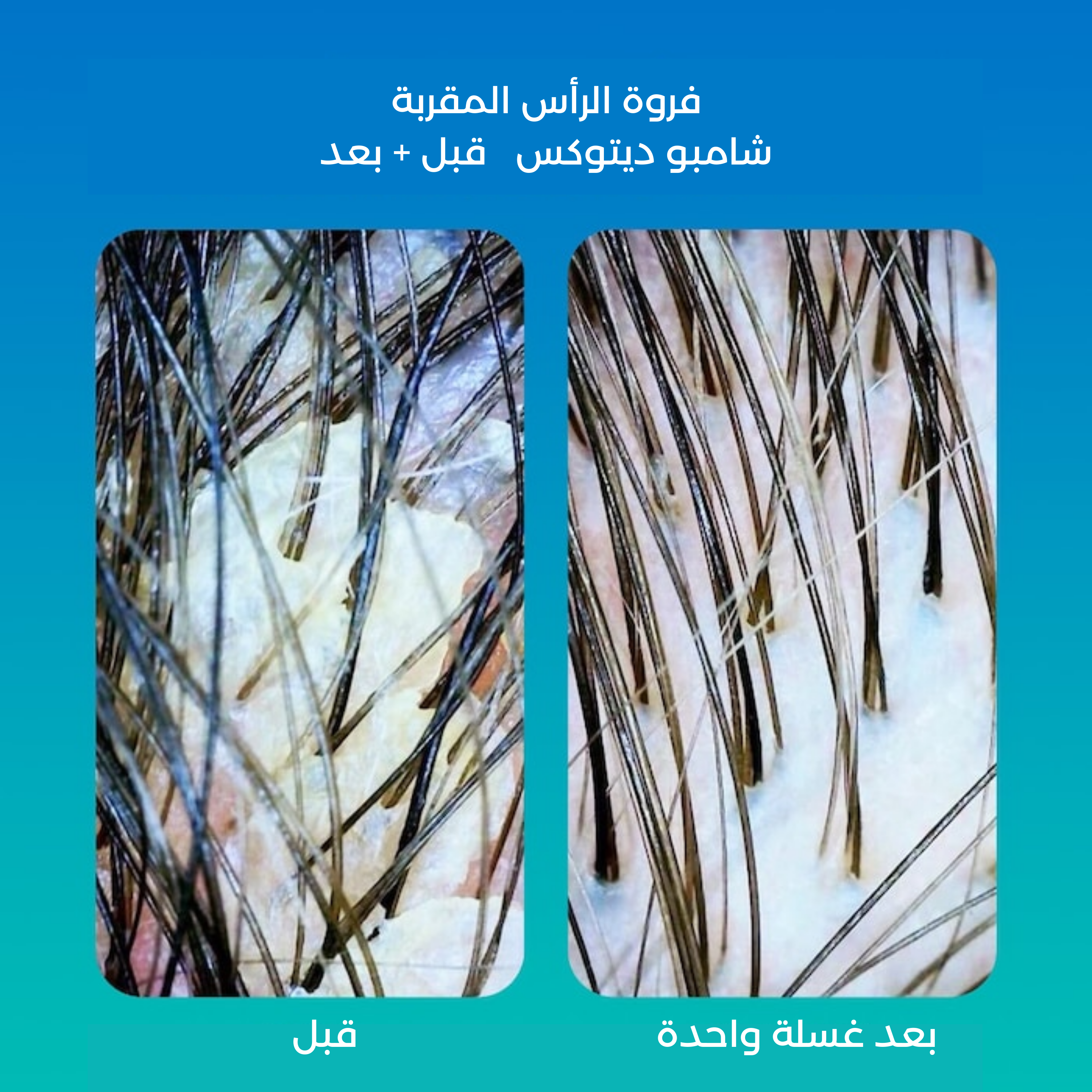 K18 قبل وبعد